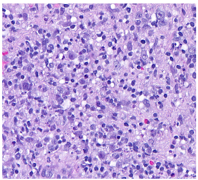 Figure 3. The horseshoe shape of LRG1.
